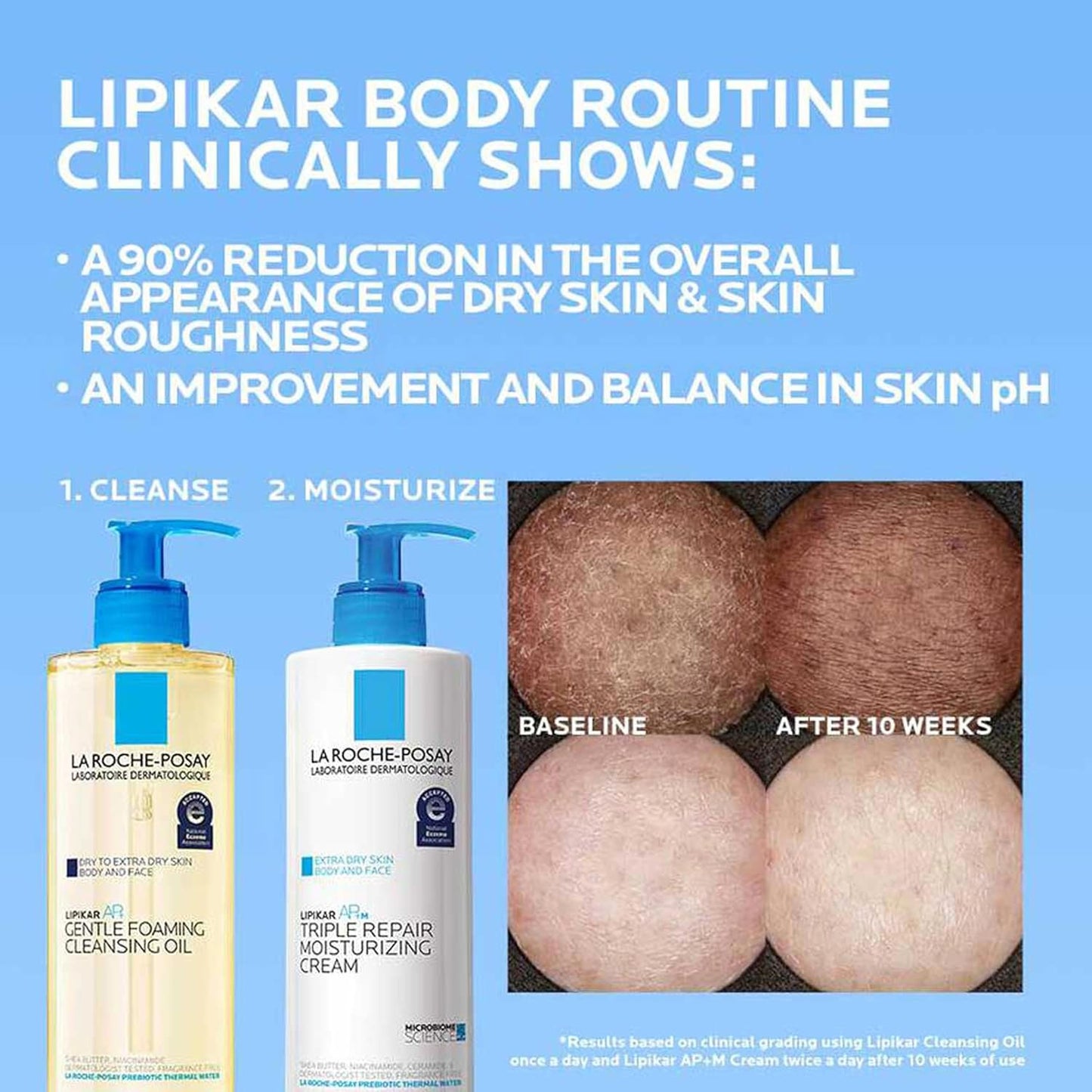 La Roche-Posay Lipikar AP+MAX Triple Repair Moisturizing Body Cream | Face & Body Lotion for Dry Skin with Shea Butter & Niacinamide | Gentle Moisturizer for Very Dry, Rough & Sensitive Skin