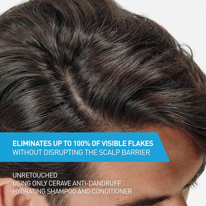 CeraVe Hydrating Anti Dandruff Conditioner, 0.5% Pyrithione Zinc Dandruff Treatment With Ceramides, Hyaluronic Acid & Niacinamide, Helps Eliminate Flakes & Reduce Itchy Scalp, Sulfate Free Conditioner | Hydrating